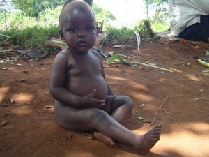 Undernourished child, Uganda1